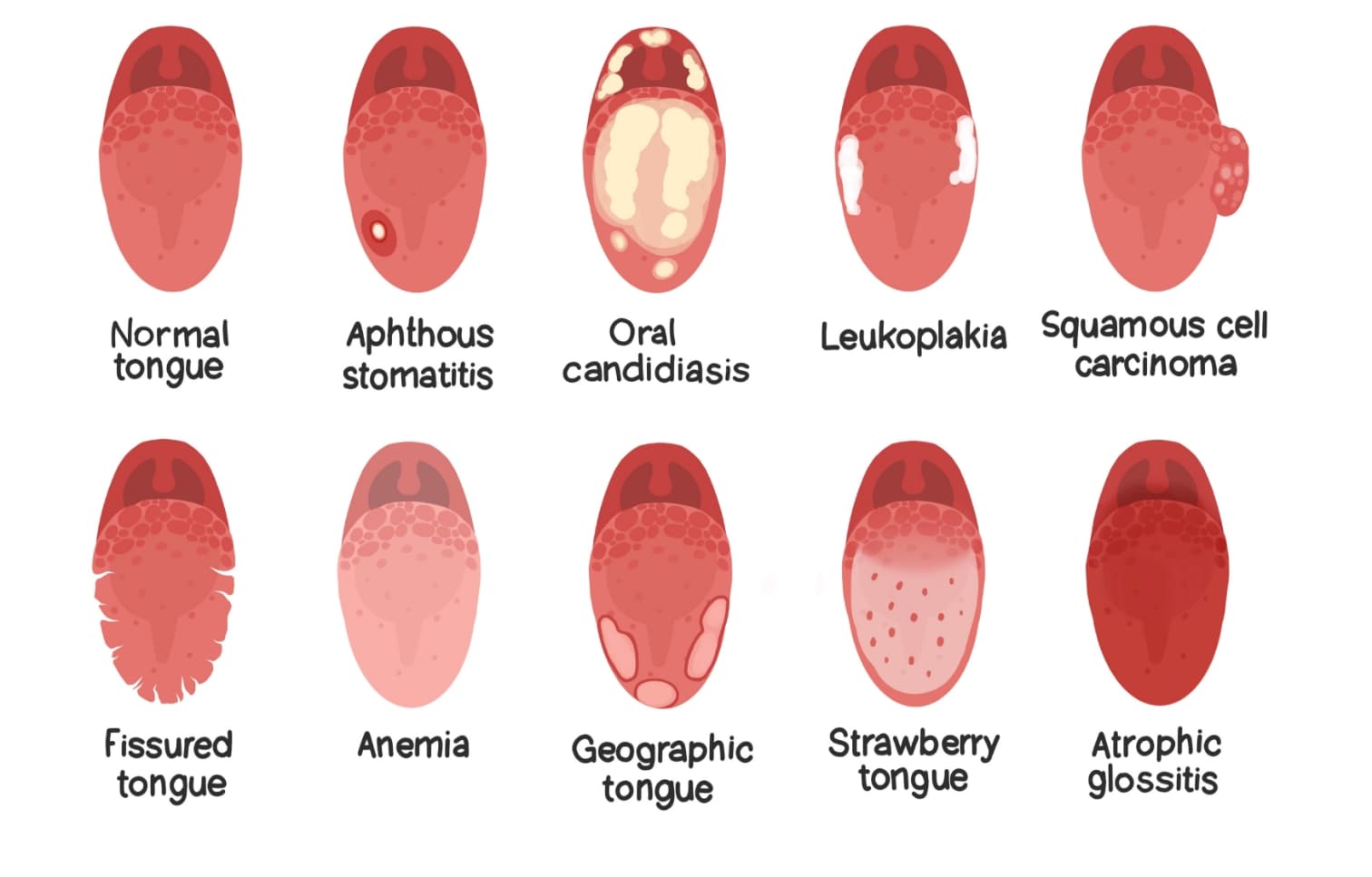 col image